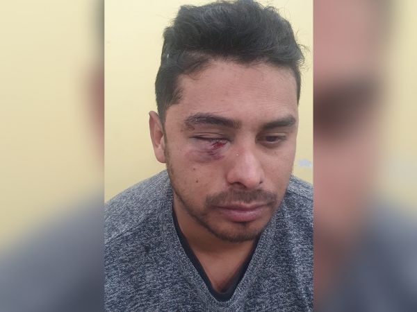 La Falda: perdi&oacute; la visi&oacute;n de un ojo por una brutal agresi&oacute;n y exige justicia