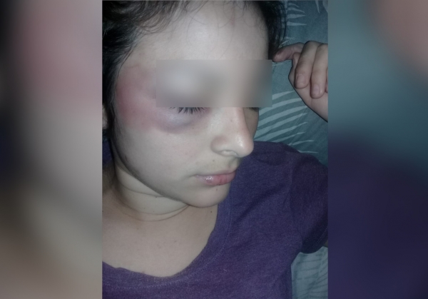 Violencia de g&eacute;nero: se tuvo que tirar de la camioneta para que dejara de golpearla